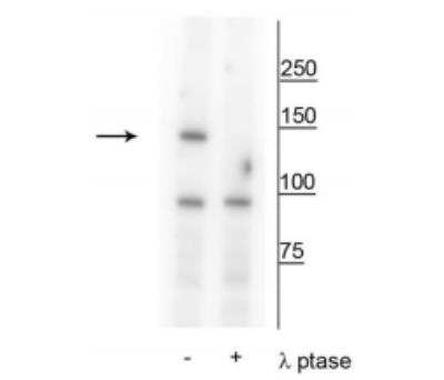 Western Blot: FANCI [p Ser559] Antibody [NBP2-60781]